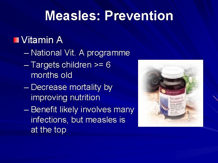 Measles: Prevention Vitamin A – National Vit. A programme – Targets children >= 6