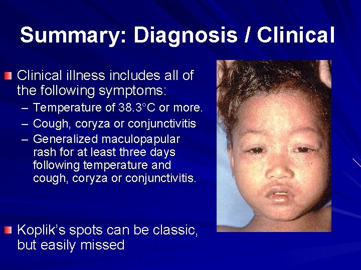 Summary: Diagnosis / Clinical illness includes all of the following symptoms: – Temperature of