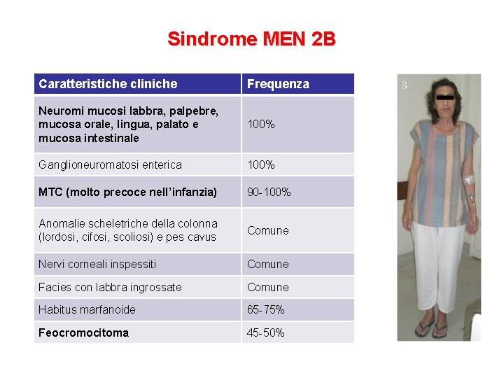 Sindrome MEN 2 B Caratteristiche cliniche Frequenza Neuromi mucosi labbra, palpebre, mucosa orale, lingua,