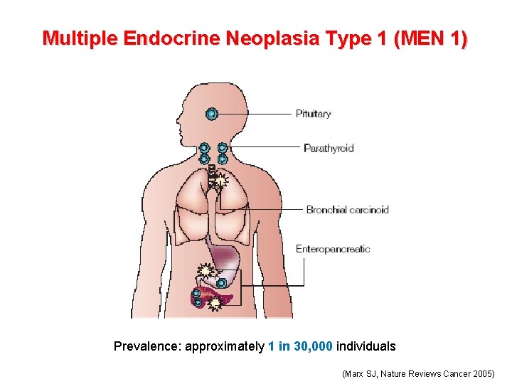Multiple Endocrine Neoplasia Type 1 (MEN 1) Prevalence: approximately 1 in 30, 000 individuals
