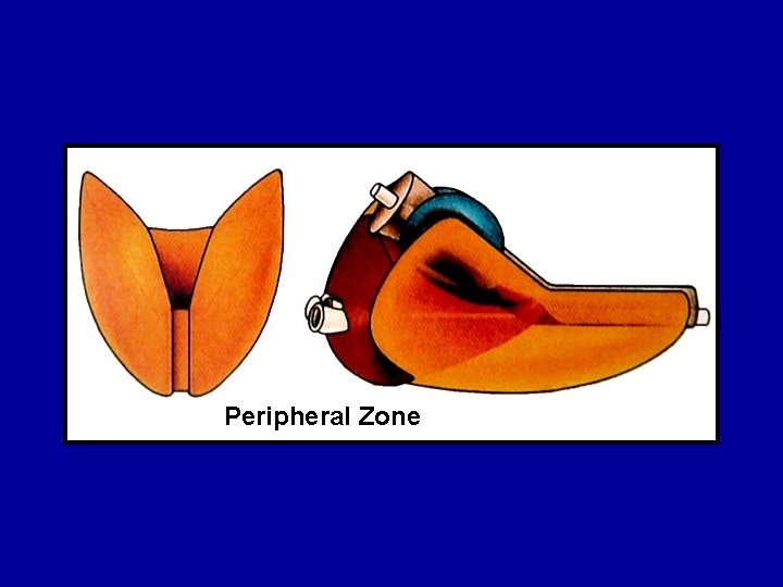 Peripheral Zone 