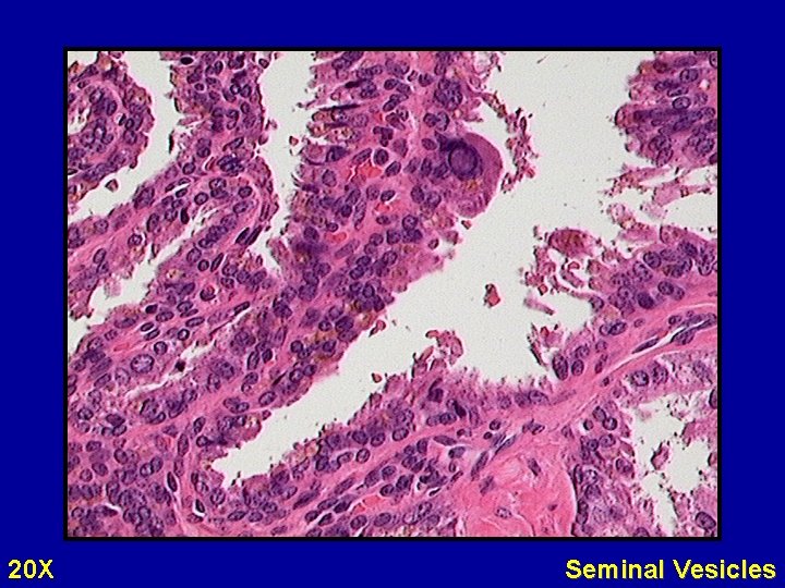 20 X Seminal Vesicles 