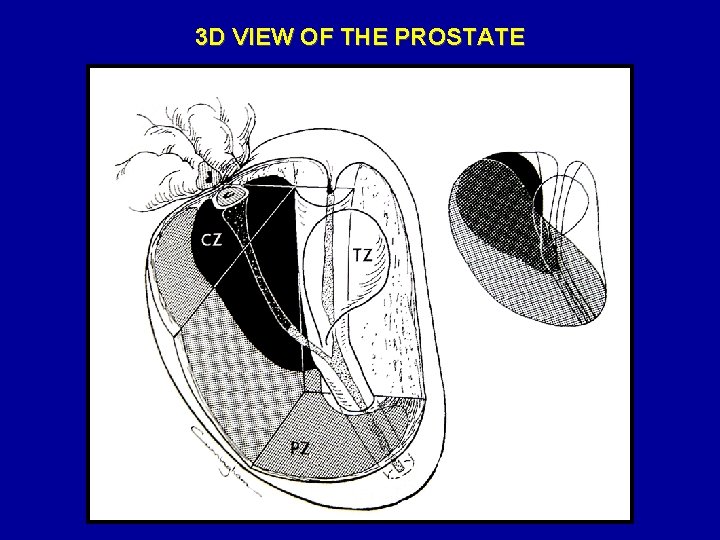 3 D VIEW OF THE PROSTATE 