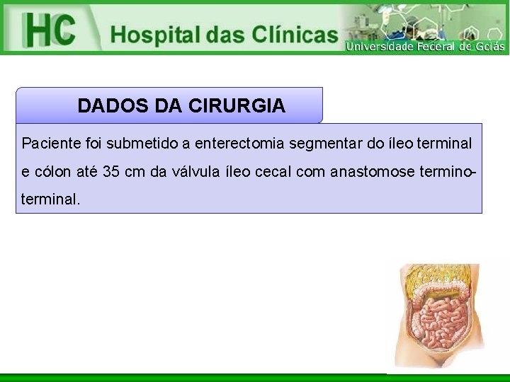 DADOS DA CIRURGIA Paciente foi submetido a enterectomia segmentar do íleo terminal e cólon