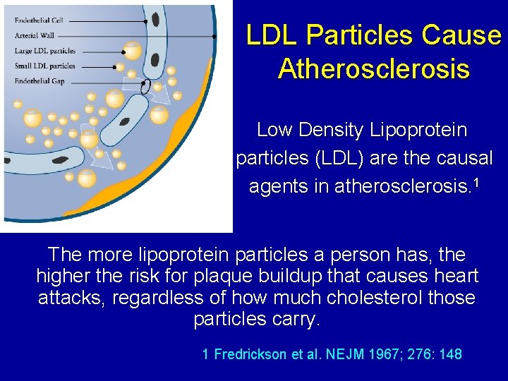 LDL Particles Cause Atherosclerosis Low Density Lipoprotein particles (LDL) are the causal agents in