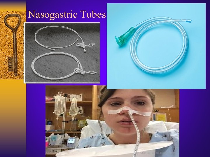 Nasogastric Tubes 