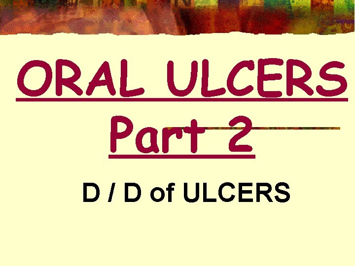 ORAL ULCERS Part 2 D / D of ULCERS 1 