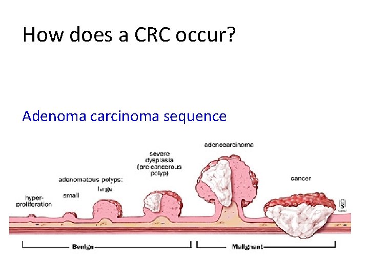 How does a CRC occur? Adenoma carcinoma sequence 