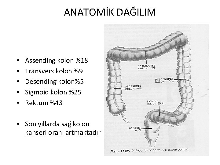 ANATOMİK DAĞILIM • • • Assending kolon %18 Transvers kolon %9 Desending kolon%5 Sigmoid