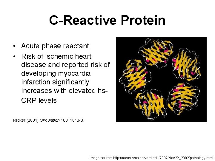 C-Reactive Protein • Acute phase reactant • Risk of ischemic heart disease and reported