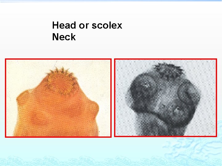 Head or scolex Neck 