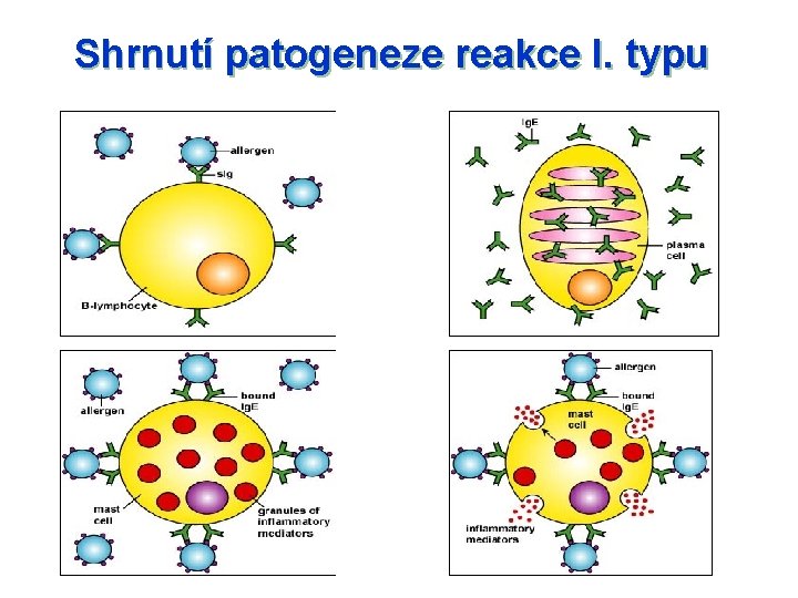 Shrnutí patogeneze reakce I. typu 