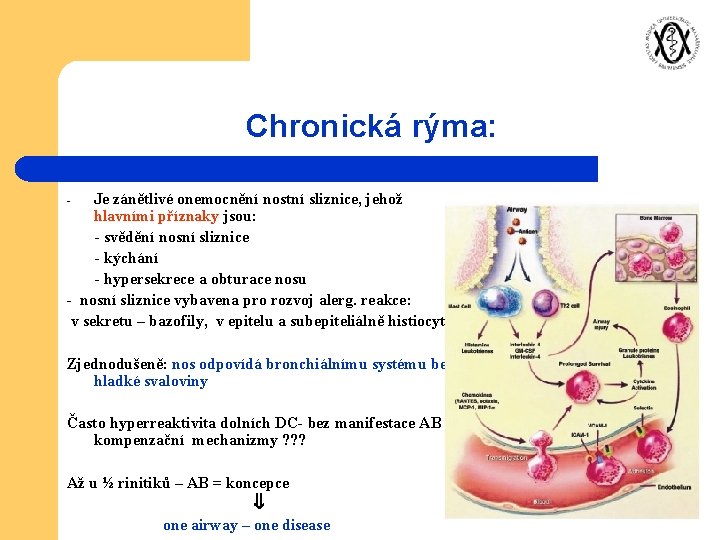 Chronická rýma: Je zánětlivé onemocnění nostní sliznice, jehož hlavními příznaky jsou: - svědění nosní