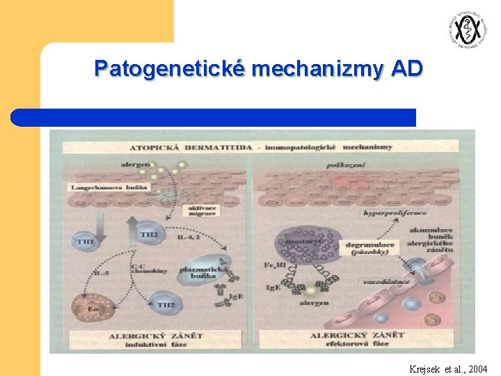 Patogenetické mechanizmy AD Krejsek et al. , 2004 