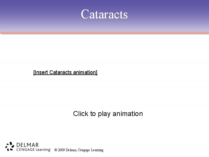 Cataracts [Insert Cataracts animation] Click to play animation © 2009 Delmar, Cengage Learning 