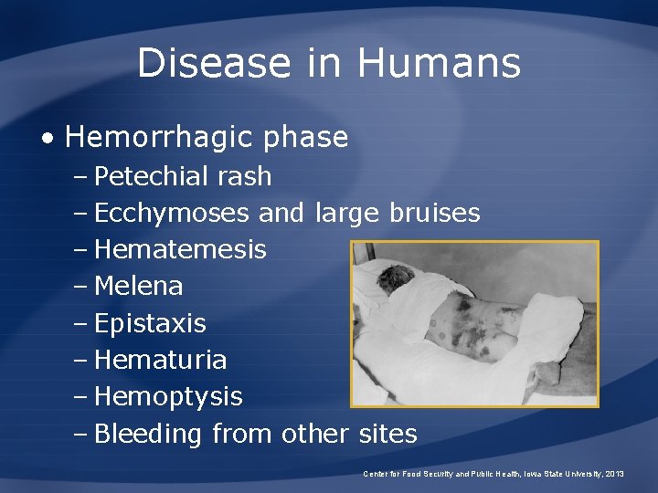 Disease in Humans • Hemorrhagic phase – Petechial rash – Ecchymoses and large bruises