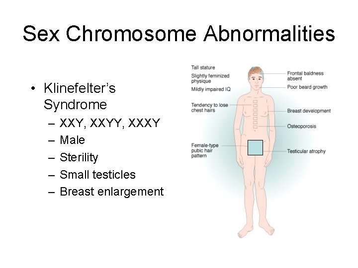 Sex Chromosome Abnormalities • Klinefelter’s Syndrome – – – XXY, XXYY, XXXY Male Sterility