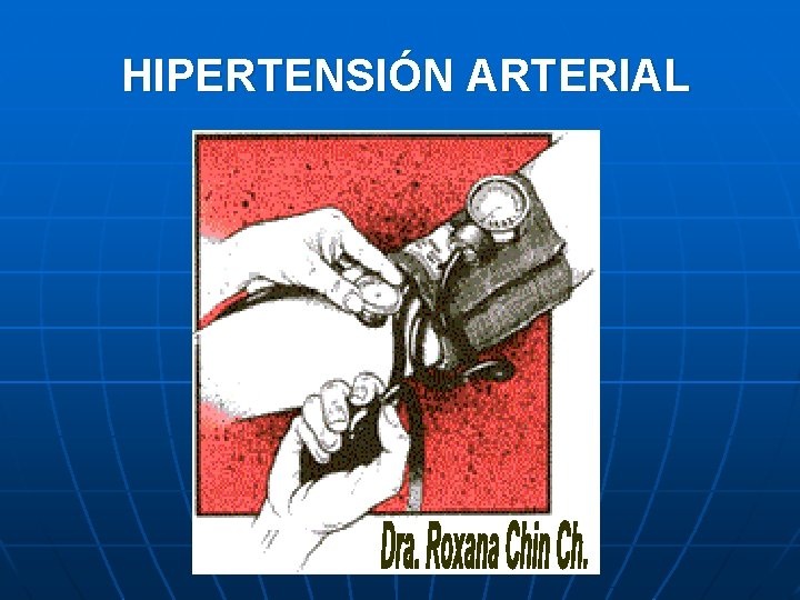 HIPERTENSIÓN ARTERIAL 