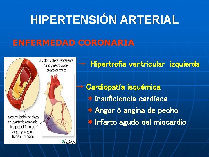 HIPERTENSIÓN ARTERIAL ENFERMEDAD CORONARIA → Hipertrofia ventricular izquierda → Cardiopatía isquémica * Insuficiencia cardíaca