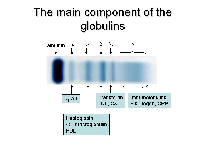 The main component of the globulins albumin 1 2 1 -AT 1 2 Transferrin