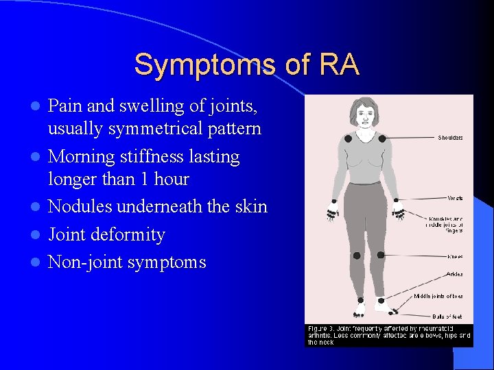Symptoms of RA l l l Pain and swelling of joints, usually symmetrical pattern Symptoms of RA l l l Pain and swelling of joints, usually symmetrical pattern