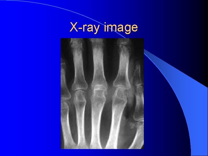 X-ray image X-ray image