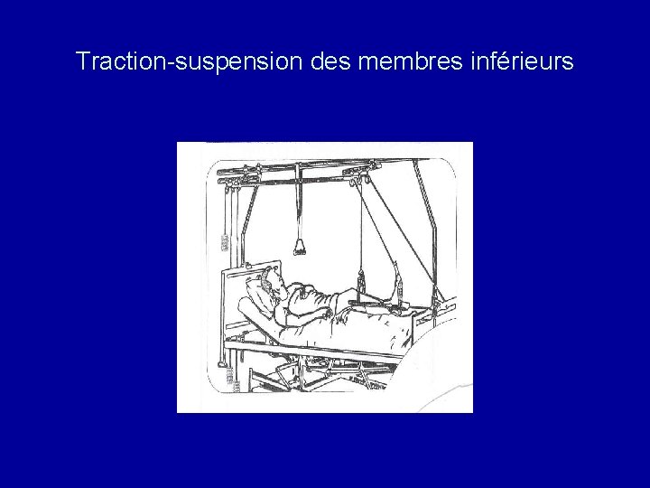 Traction-suspension des membres inférieurs 