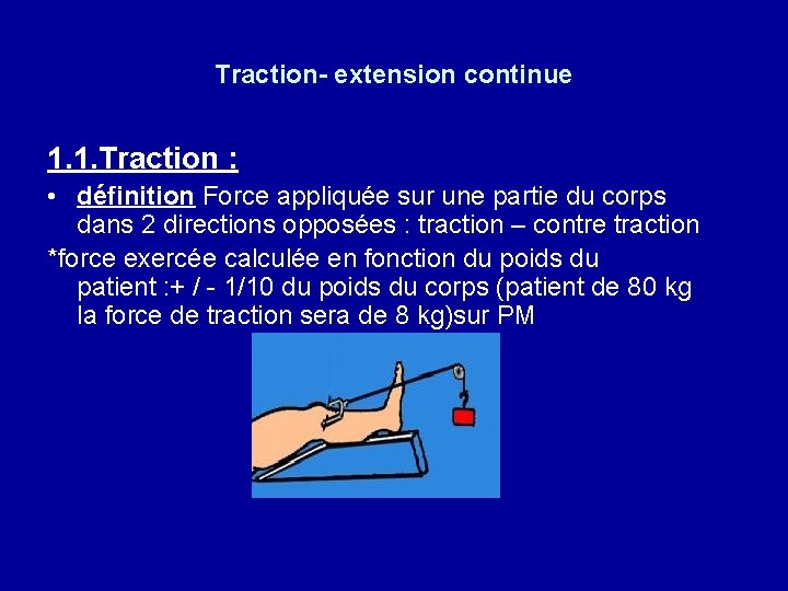 Traction- extension continue 1. 1. Traction : • définition Force appliquée sur une partie