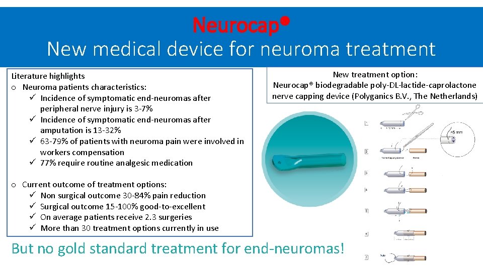 Neurocap® New medical device for neuroma treatment Literature highlights o Neuroma patients characteristics: ü