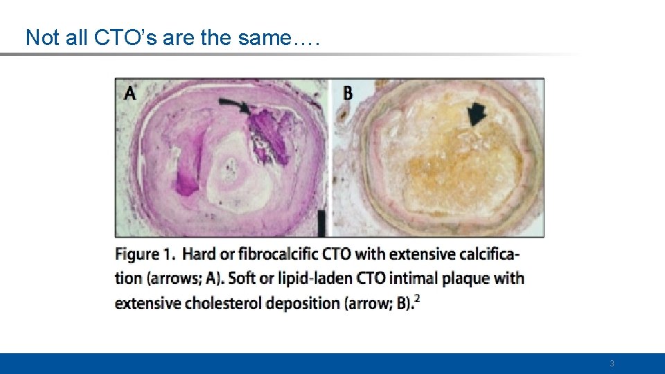 Not all CTO’s are the same…. 3 