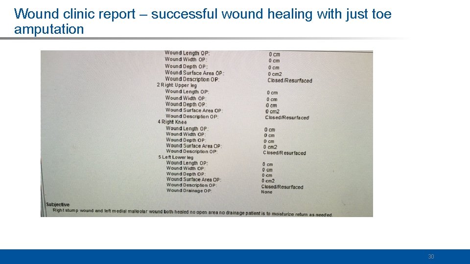 Wound clinic report – successful wound healing with just toe amputation 30 