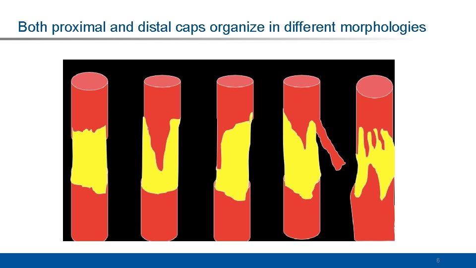 Both proximal and distal caps organize in different morphologies 6 
