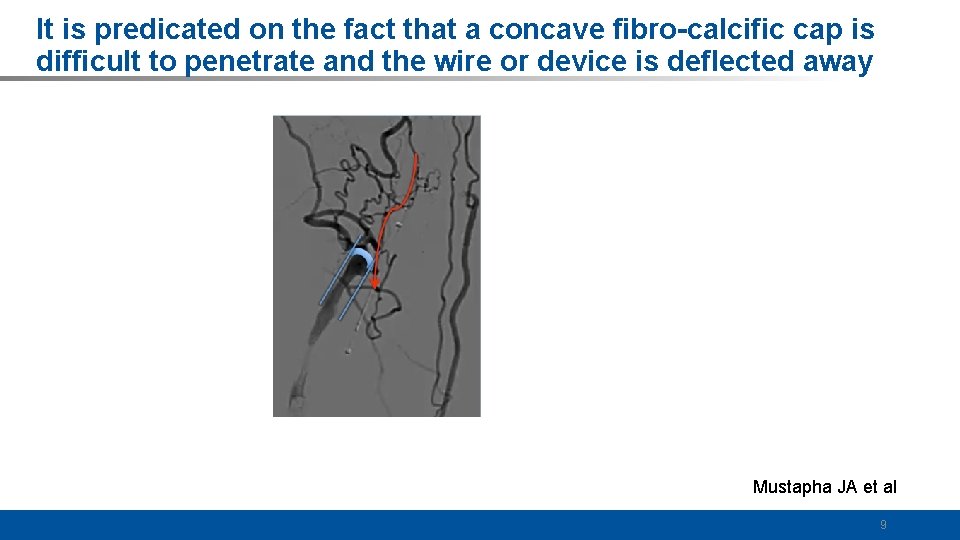It is predicated on the fact that a concave fibro-calcific cap is difficult to