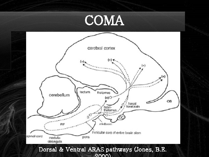 COMA Dorsal & Ventral ARAS pathways (Jones, B. E. 