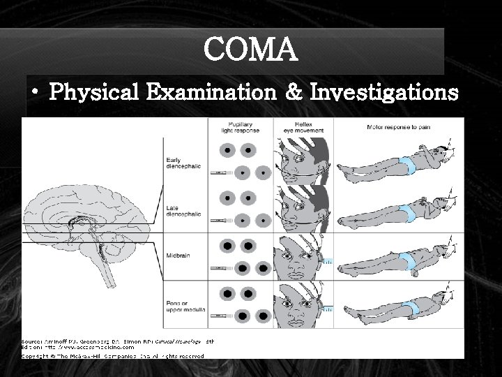 COMA • Physical Examination & Investigations 