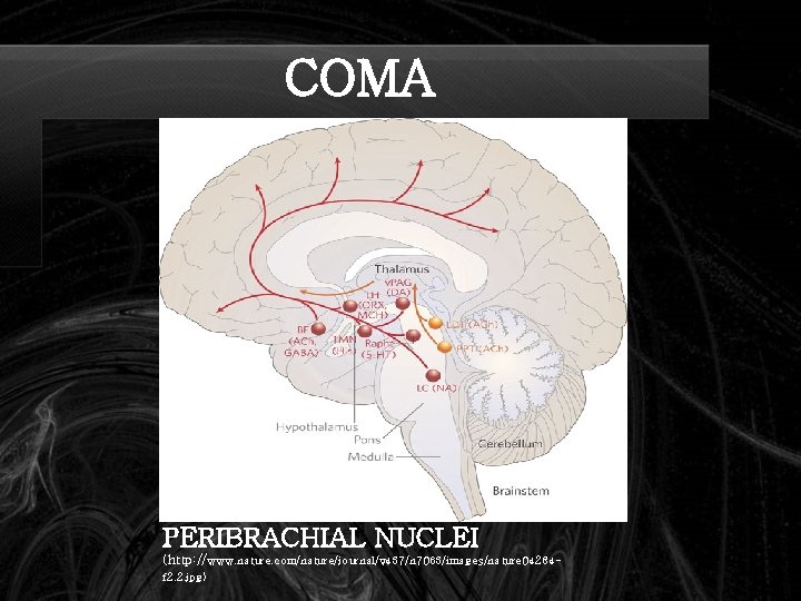 COMA PERIBRACHIAL NUCLEI (http: //www. nature. com/nature/journal/v 437/n 7063/images/nature 04284 f 2. 2. jpg)