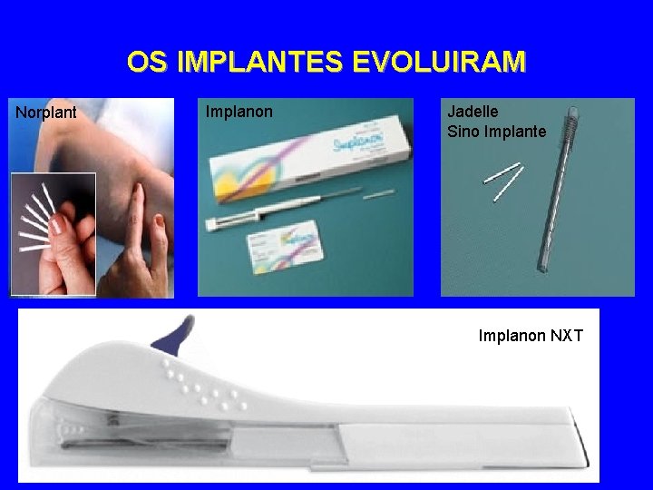 OS IMPLANTES EVOLUIRAM Norplant Implanon Jadelle Sino Implante Implanon NXT 