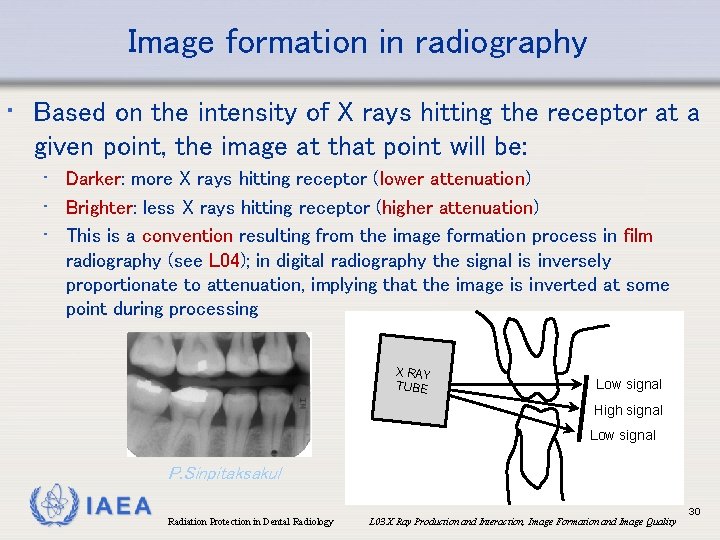 Image formation in radiography • Based on the intensity of X rays hitting the