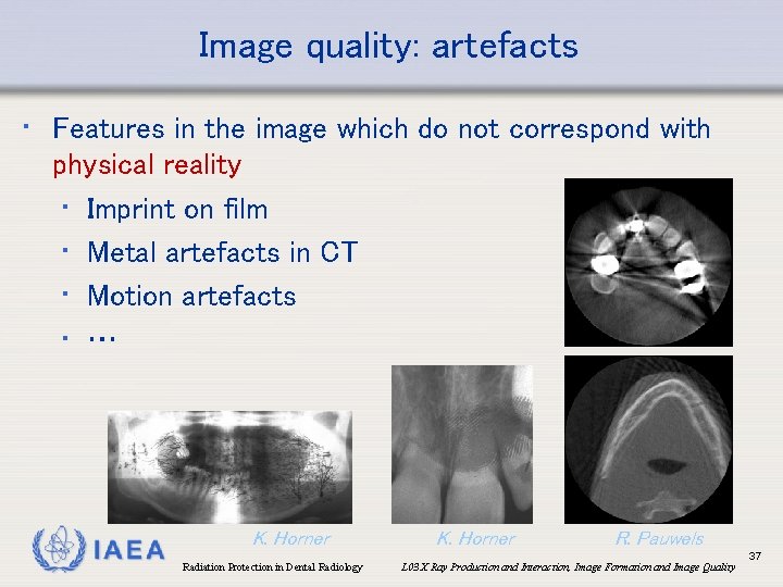 Image quality: artefacts • Features in the image which do not correspond with physical
