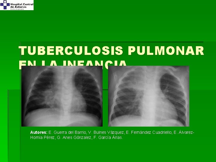 TUBERCULOSIS PULMONAR EN LA INFANCIA Autores: E. Guerra del Barrio, V. Bulnes Vázquez, E.