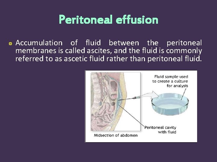 Peritoneal effusion Accumulation of fluid between the peritoneal membranes is called ascites, and the