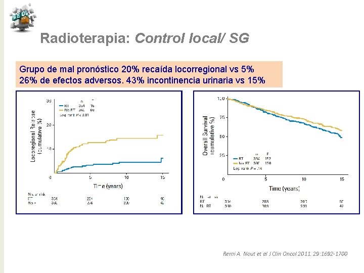 Radioterapia: Control local/ SG Grupo de mal pronóstico 20% recaída locorregional vs 5% 26%