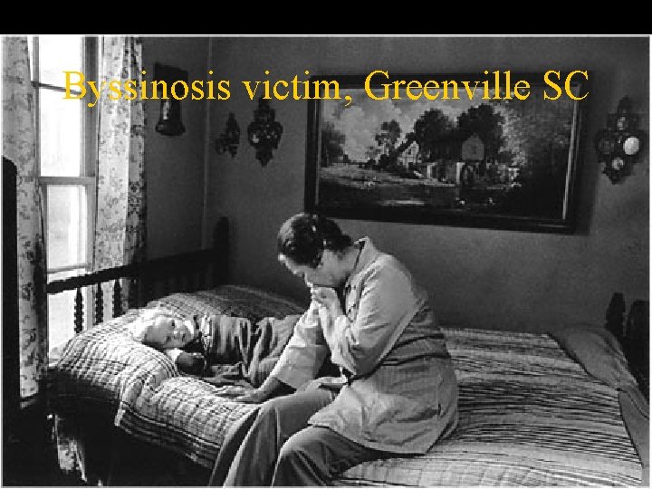 Byssinosis victim, Greenville SC 