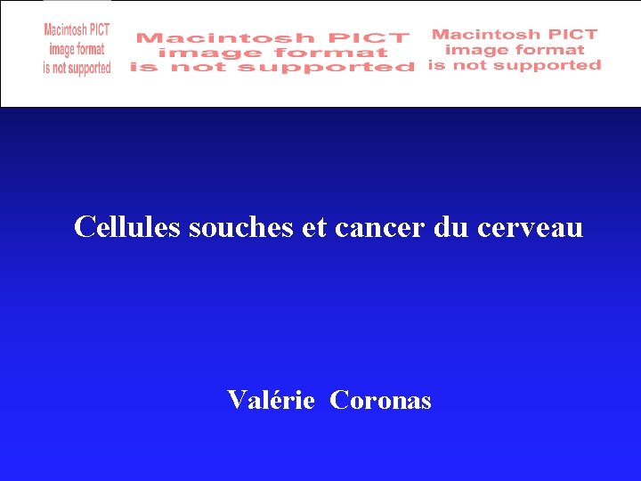 Cellules souches et cancer du cerveau Valérie Coronas 