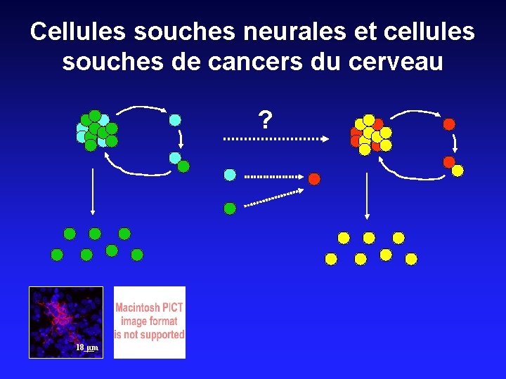 Cellules souches neurales et cellules souches de cancers du cerveau ? 18 µm 