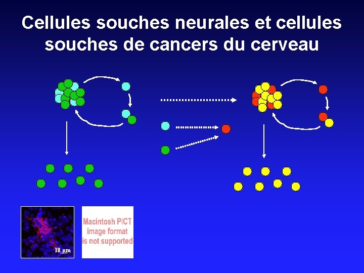 Cellules souches neurales et cellules souches de cancers du cerveau 18 µm 