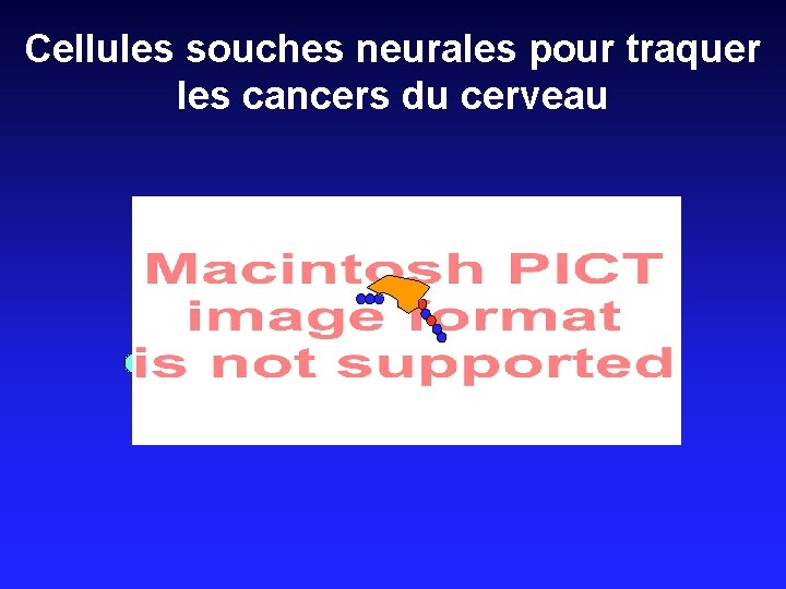 Cellules souches neurales pour traquer les cancers du cerveau 