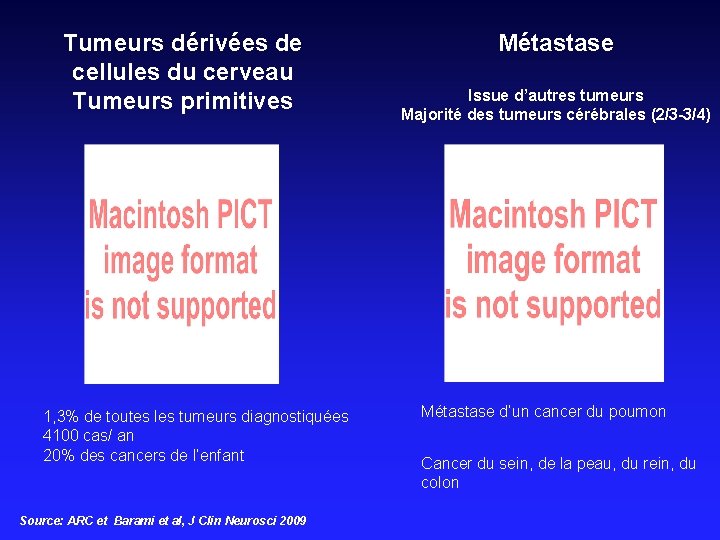 Tumeurs dérivées de cellules du cerveau Tumeurs primitives 1, 3% de toutes les tumeurs