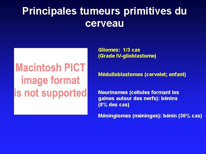 Principales tumeurs primitives du cerveau Gliomes: 1/3 cas (Grade IV-glioblastome) Médulloblastomes (cervelet; enfant) Neurinomes