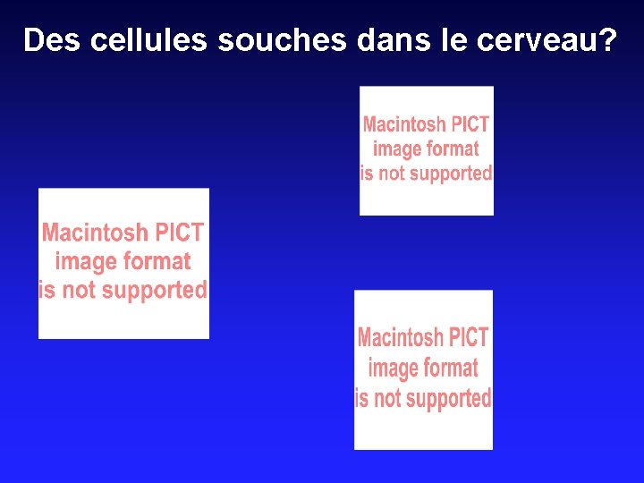 Des cellules souches dans le cerveau? 